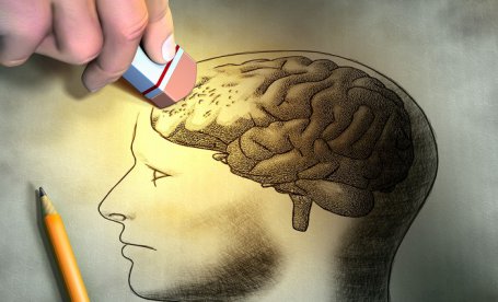 Болезнь Альцгеймера: признаки  на ранней стадии